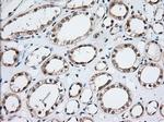 MOBKL1A Antibody in Immunohistochemistry (Paraffin) (IHC (P))