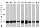 MOBKL1A Antibody in Western Blot (WB)