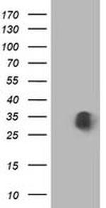 MOBKL1A Antibody in Western Blot (WB)