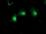 MPI Antibody in Immunocytochemistry (ICC/IF)