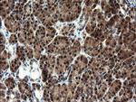 MPI Antibody in Immunohistochemistry (Paraffin) (IHC (P))