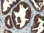 MPI Antibody in Immunohistochemistry (Paraffin) (IHC (P))