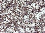 MPI Antibody in Immunohistochemistry (Paraffin) (IHC (P))