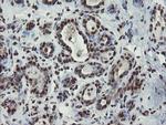 MPI Antibody in Immunohistochemistry (Paraffin) (IHC (P))