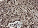 MPI Antibody in Immunohistochemistry (Paraffin) (IHC (P))