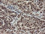 MPI Antibody in Immunohistochemistry (Paraffin) (IHC (P))