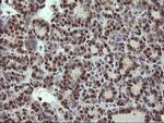 MPI Antibody in Immunohistochemistry (Paraffin) (IHC (P))