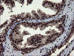 MPI Antibody in Immunohistochemistry (Paraffin) (IHC (P))