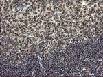 MPI Antibody in Immunohistochemistry (Paraffin) (IHC (P))