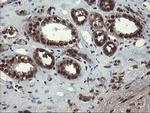 MPI Antibody in Immunohistochemistry (Paraffin) (IHC (P))