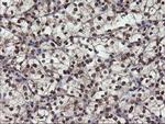 MPI Antibody in Immunohistochemistry (Paraffin) (IHC (P))