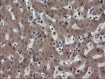 MPI Antibody in Immunohistochemistry (Paraffin) (IHC (P))