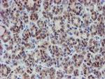 MPI Antibody in Immunohistochemistry (Paraffin) (IHC (P))