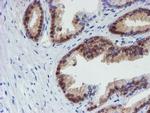 MPI Antibody in Immunohistochemistry (Paraffin) (IHC (P))