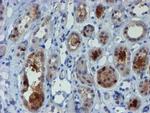 MPI Antibody in Immunohistochemistry (Paraffin) (IHC (P))