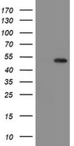 MPI Antibody in Western Blot (WB)