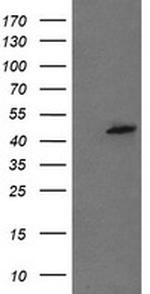 MPI Antibody in Western Blot (WB)