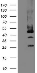 MPI Antibody in Western Blot (WB)