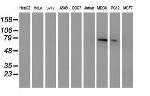 MPP5 Antibody in Western Blot (WB)