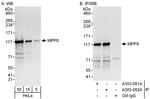 MPP8 Antibody in Western Blot (WB)