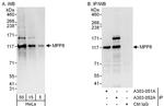 MPP8 Antibody in Western Blot (WB)