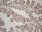 MRPL10 Antibody in Immunohistochemistry (Paraffin) (IHC (P))