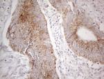 MRPL10 Antibody in Immunohistochemistry (Paraffin) (IHC (P))