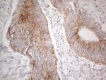 MRPL10 Antibody in Immunohistochemistry (Paraffin) (IHC (P))