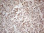 MRPL10 Antibody in Immunohistochemistry (Paraffin) (IHC (P))