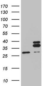 MRPL10 Antibody in Western Blot (WB)