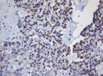 MRPL11 Antibody in Immunohistochemistry (Paraffin) (IHC (P))