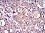 MRPL42 Antibody in Immunohistochemistry (Paraffin) (IHC (P))