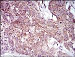 MRPL42 Antibody in Immunohistochemistry (Paraffin) (IHC (P))