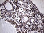 MRPL44 Antibody in Immunohistochemistry (Paraffin) (IHC (P))