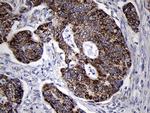 MRPL44 Antibody in Immunohistochemistry (Paraffin) (IHC (P))