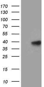 MRPL44 Antibody in Western Blot (WB)