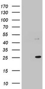 MRPS11 Antibody in Western Blot (WB)