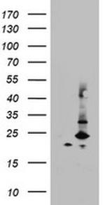 MRPS11 Antibody in Western Blot (WB)