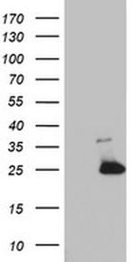 MRPS11 Antibody in Western Blot (WB)