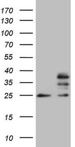 MRPS15 Antibody in Western Blot (WB)