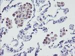 MRPS27 Antibody in Immunohistochemistry (Paraffin) (IHC (P))