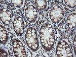 MRPS34 Antibody in Immunohistochemistry (Paraffin) (IHC (P))