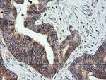 MRPS34 Antibody in Immunohistochemistry (Paraffin) (IHC (P))