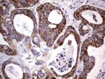 MRPS7 Antibody in Immunohistochemistry (Paraffin) (IHC (P))