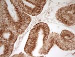 MRRF Antibody in Immunohistochemistry (Paraffin) (IHC (P))