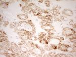 MRRF Antibody in Immunohistochemistry (Paraffin) (IHC (P))