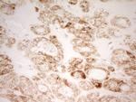 MRRF Antibody in Immunohistochemistry (Paraffin) (IHC (P))