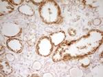 MRRF Antibody in Immunohistochemistry (Paraffin) (IHC (P))