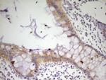 MRRF Antibody in Immunohistochemistry (Paraffin) (IHC (P))