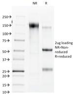 Connexin 32 (Gap Junction Protein) Antibody in SDS-PAGE (SDS-PAGE)